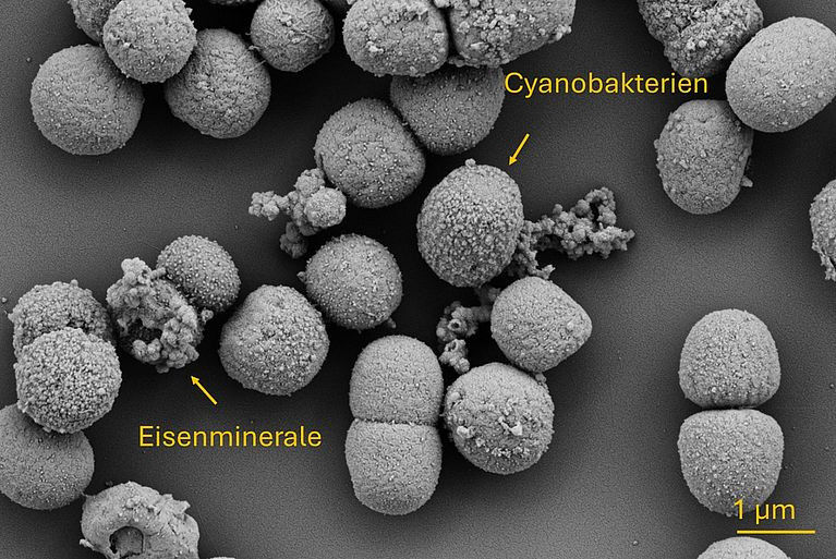 Scanning electron microscope images of the spherical cyanobacteria Synechococcus