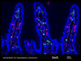 Chemotherapy reprograms gut bacteria to slow metastases