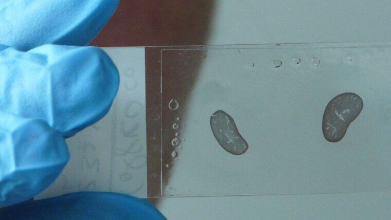 Life Sciences - Microscope slide with the tissue section of a mouse kidney Image: Uta von der Gönna (UKJ) Life Sciences