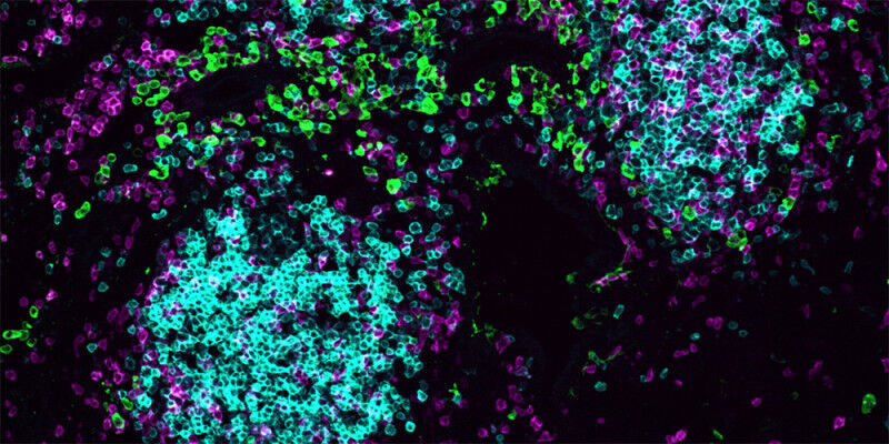 Health - Clusters of immune cells in the influenza-infected lung of a mouse. B cells are shown in cyan, T cells in magenta, and green areas indicate regions with low oxygen levels. Oxygen is particularly scarc Health