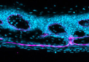 Remodelling skull bone architecture to boost the brain's immune defences