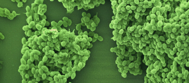 Scanning electron microscopy image of Enterococcus faecalis bacteria in a biofil