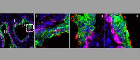 The secret route of prostate infections