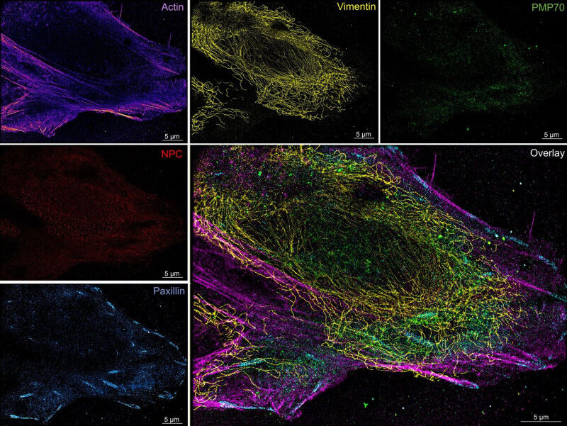 Physics - Multiplexed super-resolution image of targets inside the same U2OS cell taken using the newly developed microfluidics system. Target molecules in the sample are labelled with DNA featuring different s Physics