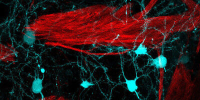 When a virus releases the immune brake: New evidence on the onset of multiple sclerosis