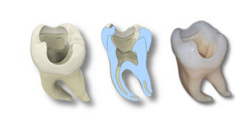 A 3D-printed Tooth That Can Do Everything