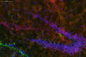 A new approach to combatting anxiety states, pain and inflammation