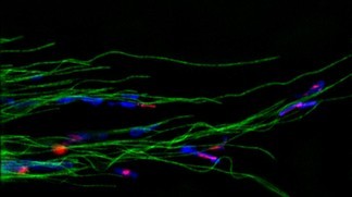 SiR-tubulin stained in green�Kai Johnsson/EPFL