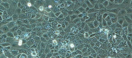 A platform to test new cancer treatments