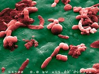 Scanning electron microscope image of a sample of human faeces, showing the abun
