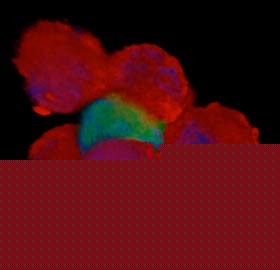 Assembling cells into artificial 3-D tissues, like tiny glands