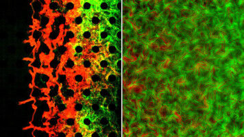 Breaking through the protective barrier of bacteria