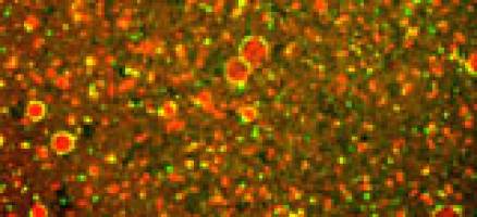 Bursting bubbles with sound offers new treatments for cancer