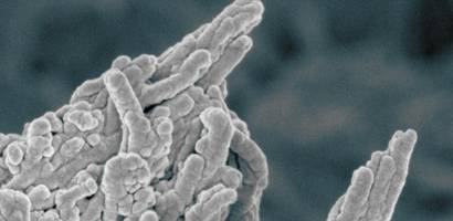 Cause of hardening of the arteries - and potential treatment - identified