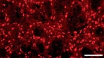 Central role of PGC-1? in dopaminergic neurons