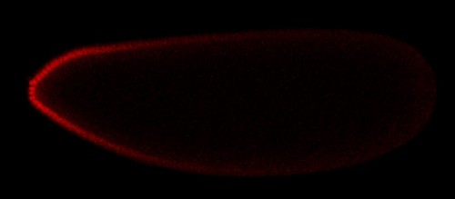 The Princeton team used confocal microscopy to visualize the spatial distributio