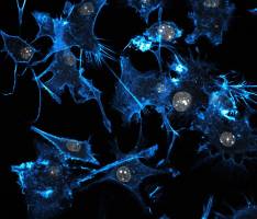 Double hit on melanoma unlocks barrier to immunotherapy