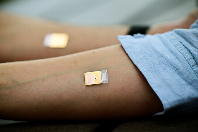 Example of how the DXcrete wearable patch can be worn on the body. Photo: Bart v
