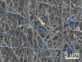Electrically spun fabric offers dual defense against pregnancy, HIV