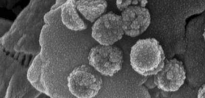 Engineers' new nanoscavenger purifies water, gets retrieved by magnet