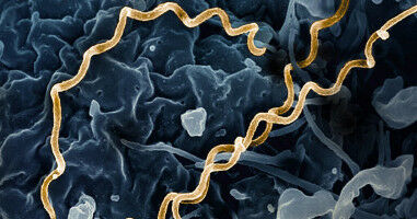Expert insight: Why are syphilis cases on the rise in�Canada?