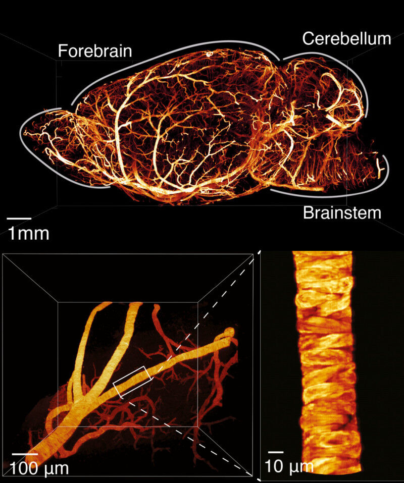 Health - Side view of a mouse brain (left) and detailed images of a blood vessel (right) made using the technologically innovative platform designed for light sheet fluorescence microscopy developed by researc Health