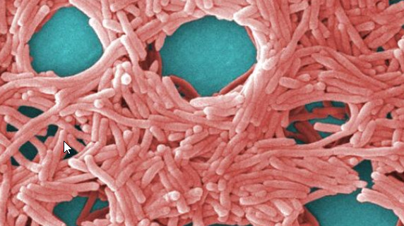 Large grouping of Legionella pneumophila. Janice Haney Carr/CDC