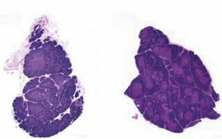 First 3D images of complete human thymus illuminate its structure and function
