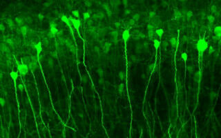 Gene therapy targeting overactive brain cells could treat neurological disorders