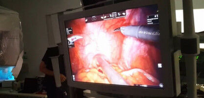 Glowing dye helps surgeons eradicate prostate cancer