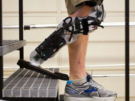 How does property law affect implanted medical devices?