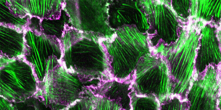 The image shows the skin epithelial cells used in the study, which originate fro