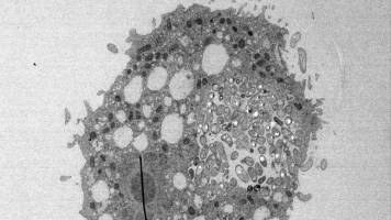 How the cholera bacterium survives water predators