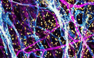 Images showcase life-changing UCL research