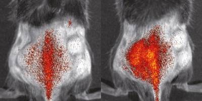 Immune cells in the spotlight