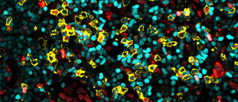 Immune guardians in the lymph node