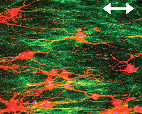 To treat severe nerve damage,   of Molecular Biology Jean Schwarzbauer and  of C