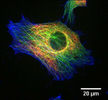 Interdisciplinary PhDs in biological physics