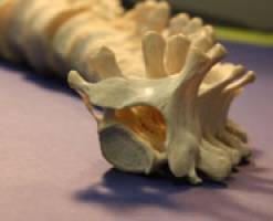 Learning from old bones to treat modern back pain