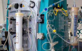 Liver dialysis device proved safe and effective for treating severe liver failure