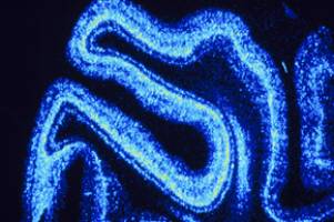 Looking at the micro could mend broken hearts