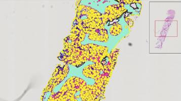 MarrowQuant: a digital-pathology tool