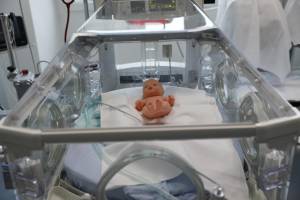 Medically monitoring premature babies with cameras