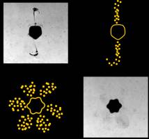 Microbubbles controlled by acoustical tweezers for highly localized drug release