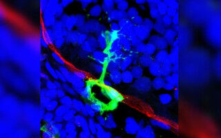 A better understanding of the blood-brain barrier