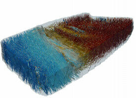 Migraine research and beating human hearts: News from Imperial