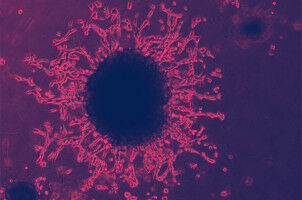 'Mini-placentas' shed light on early events that are key for a successful pregnancy