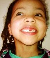 Molar power: Milk teeth wanted for stem cell palace art project