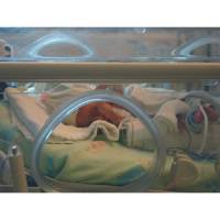 More babies survive before 27 weeks, but severe disability rates unchanged