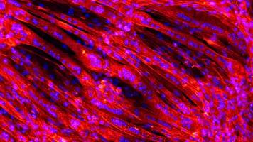 Muscles out of a spray can